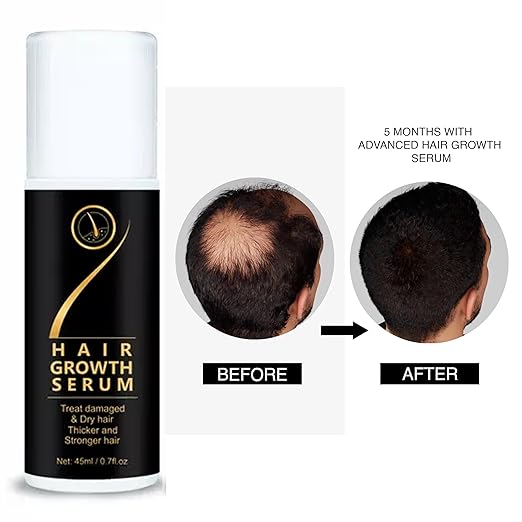 Hair Growth Serum & Treat Damaged & Dry Hair Thicker and Stronger Hair